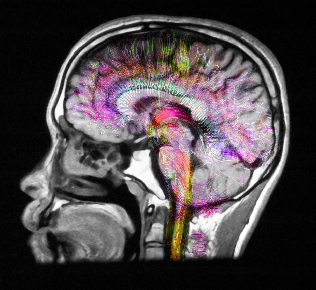 Brain scans have helped scientists understand why other people are more likely to get candy handed to them. (Credit: Getty Images)