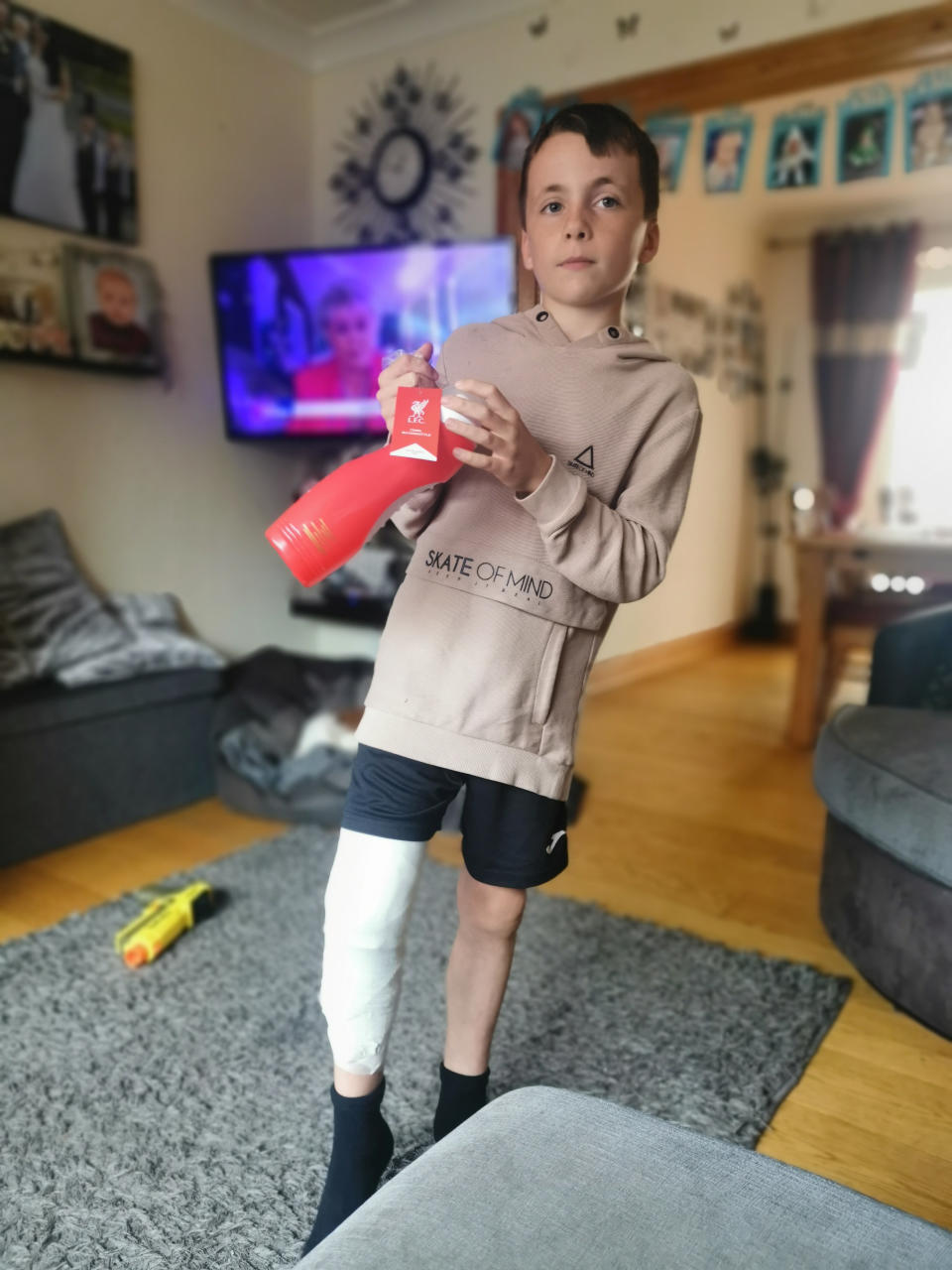 Jayden Bird at home after being treated for his burns. See SWNS story SWTPhogweed. A mum has issued a warning after her son received these horrific third degree burns from HOGWEED - dubbed Britain's most dangerous plant. Jayden Bird, nine, rubbed his leg against the toxic weed which is thriving thanks to lockdown. He was playing with his siblings while on a camping holiday with his family when he ran past a patch of hogweed near some trees on the campsite. Within minutes his right leg was covered in red marks - and sixteen hours later they erupted into puss-filled blisters leaving him in agony. 