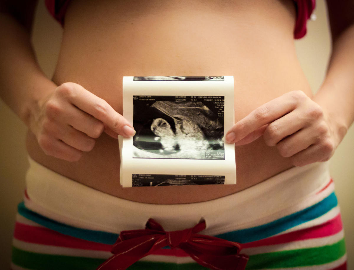 La Grossesse Échographie Photo - Getty Images