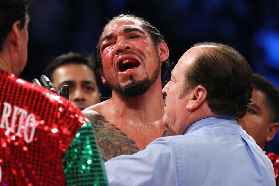 Antonio Margarito reacts after referee Steve Smoger (R) calls the fight due to Margarito’s closed right eye against Miguel Cotto in the 10th round of their junior middleweight title fight on Dec. 3, 2011, at Madison Square Garden. (Photo by Al Bello/Getty Images)