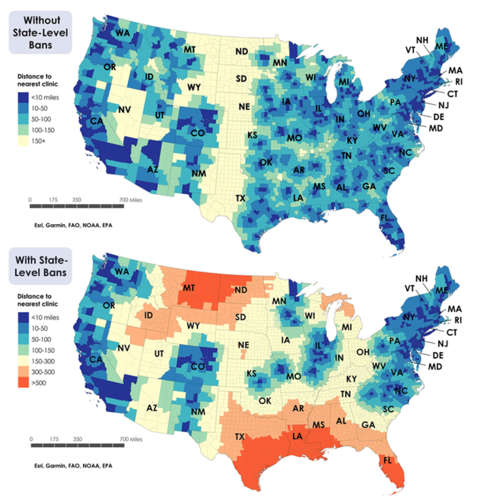 Absolute distance to an abortion clinic for every county in the US. The top map is the distance with Roe v Wade, the bottom one is the distance if state-level abortion restriction ‘trigger’ law goes into effect (Kelly et. al. (2022). Utah Women's Health)