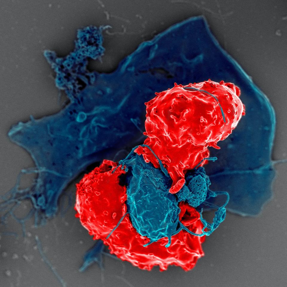 T regulatory cells (red) determine whether an immune response should be mounted. <a href="https://flic.kr/p/SjQFf7" rel="nofollow noopener" target="_blank" data-ylk="slk:NIAID/Flickr;elm:context_link;itc:0;sec:content-canvas" class="link ">NIAID/Flickr</a>, <a href="http://creativecommons.org/licenses/by/4.0/" rel="nofollow noopener" target="_blank" data-ylk="slk:CC BY;elm:context_link;itc:0;sec:content-canvas" class="link ">CC BY</a>