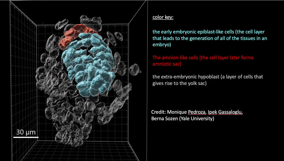 This graphic provided by Yale University shows an image of a human embryo model. (Monique Pedroza, Ipek Gassaloglu, Berna Sozen/Yale University via AP)