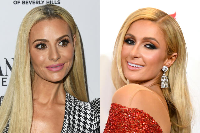 paris hilton plastic surgery before after