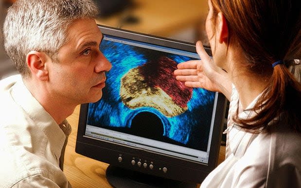 Prostate cancer is one of the most common forms of cancer - © Phanie / Alamy