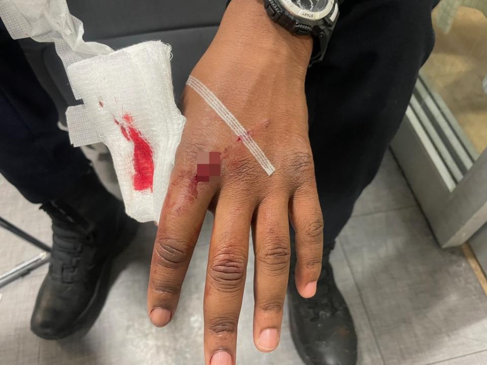 An officer got a nasty cut that required stitches to close as he tried to break up a gang fight between about 10 inmates, he told The Post.