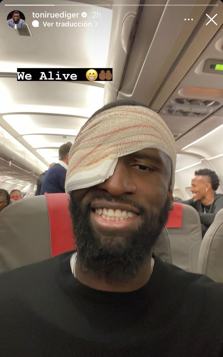 Antonio Rüdiger se tomó con humor el golpe y compartió una selfie en el avión de vuelta