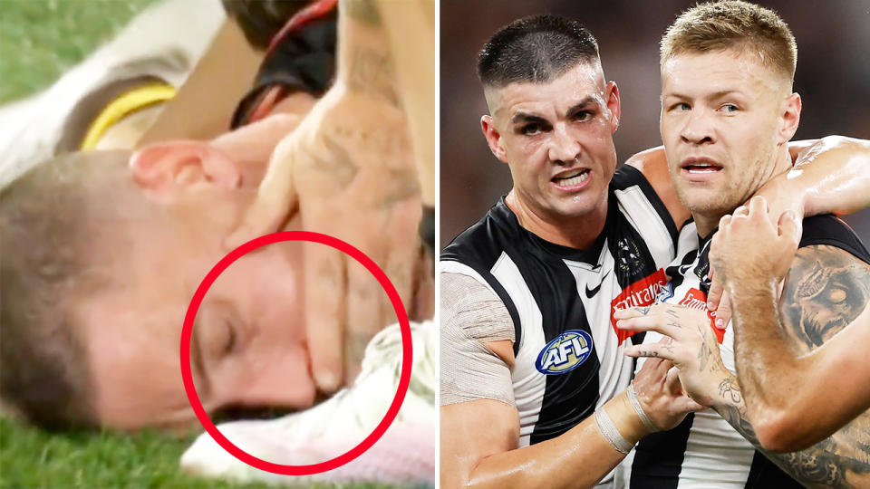Jordan De Goey, pictured here trying to hide the blood coming from Darcy Cameron's nose.