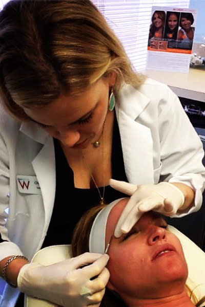 Get a professional dermaplane treatment