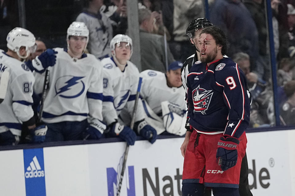 A bloodied Columbus Blue Jackets defenseman Ivan Provorov (9) is escorted off the ice in the third period of an NHL hockey game against the Tampa Bay Lightning Saturday, Feb. 10, 2024, in Columbus, Ohio. Provorov received a penalty for cross checking against Michael Eyssimont and roughing against Eyssimont. (AP Photo/Sue Ogrocki)