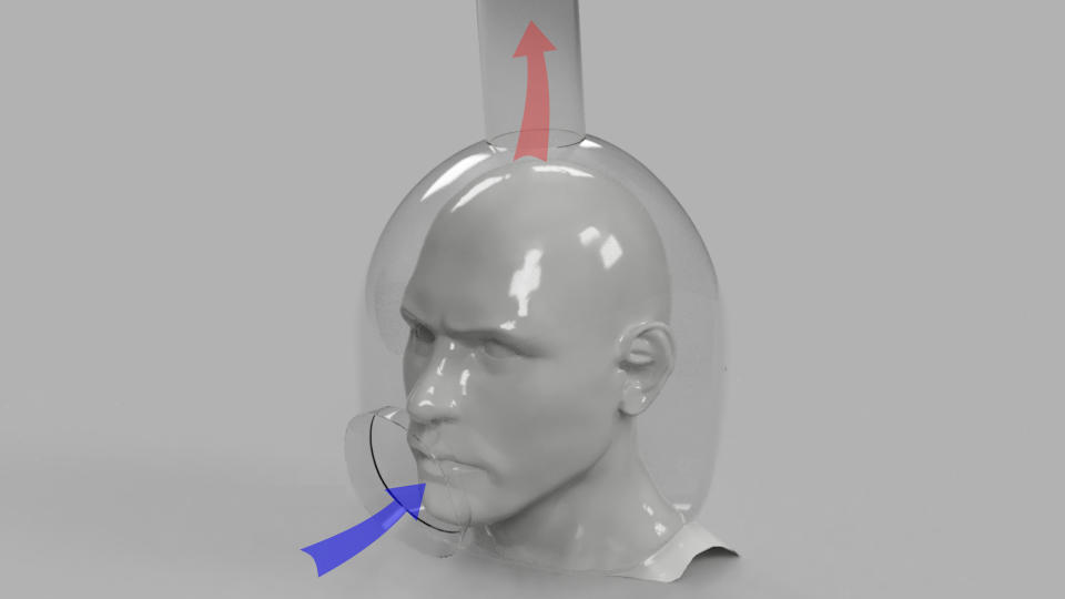 The open-faced helmet is connected to a medical-grade air filtration pump (SWNS) 