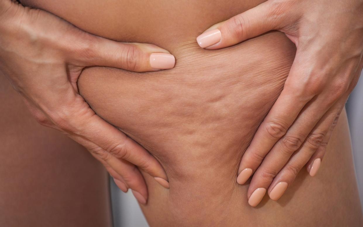 From brushing to caffeine cream, here's how to deal with cellulite, the French way