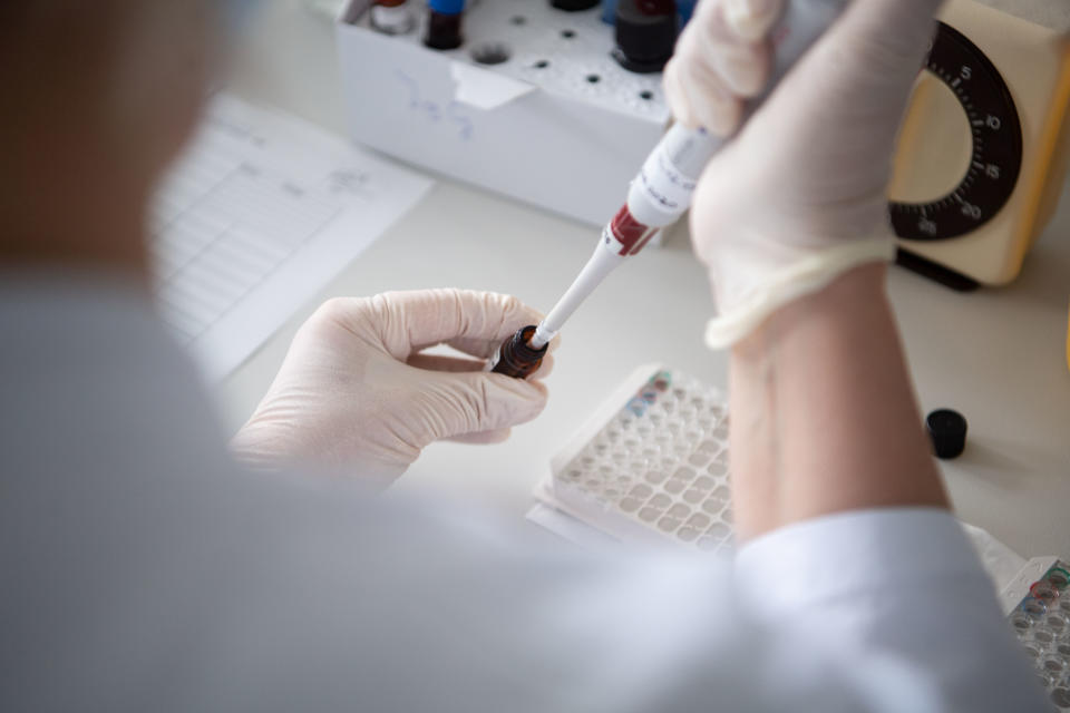 18 June 2020, Baden-Wuerttemberg, Stuttgart: During a visit of Baden-Württemberg's Minister President Kretschmann, a staff member of the Baden-Württemberg Health Authority tests blood samples for antibodies. The State Health Office is the technical control centre for the public health service in Baden-Württemberg. This is where the corona crisis comes together. Photo: Marijan Murat/dpa (Photo by Marijan Murat/picture alliance via Getty Images)