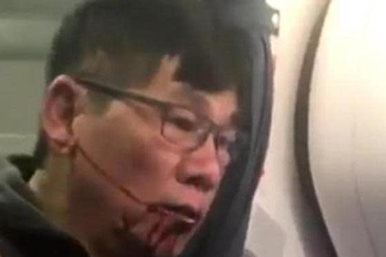 David Dao: Shocking images showed the passenger bleeding from his mouth