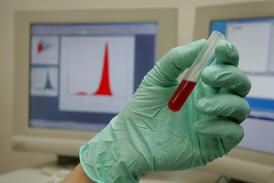 FILE - An Aug. 3, 2004 photo from files showing an unidentified laboratory assistant looking at a blood test at the WADA laboratories in Lausanne, Switzerland. FIFA’s medical chief, Michel D’Hooghe, says he is “really not happy” with drug-testing plans for the World Cup in Brazil, because samples taken from players must be flown across the Atlantic to a laboratory in Switzerland for analysis, possibly slowing results. FIFA had to turn to the lab in Lausanne because the Brazilian facility that was expected to analyze World Cup samples repeatedly failed to comply with World Anti-Doping Agency standards and so lost its authority to do testing.(AP Photo/Keystone, Fabrice Coffrini), File)