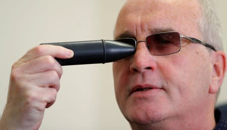 Richard Moore, CEO of Children in the Crossfire, shows where he was hit in the face and blinded by a rubber bullet when he was 10 years old, during an interview in Londonderry, Northern Ireland