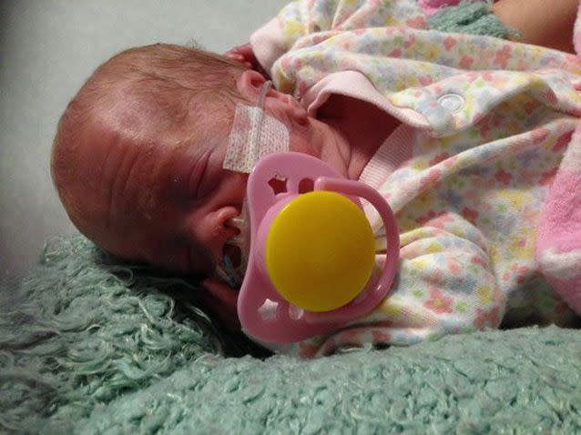 Tilly-Sue suffered through several setbacks after her premature birth. Photo: South Wales Echo