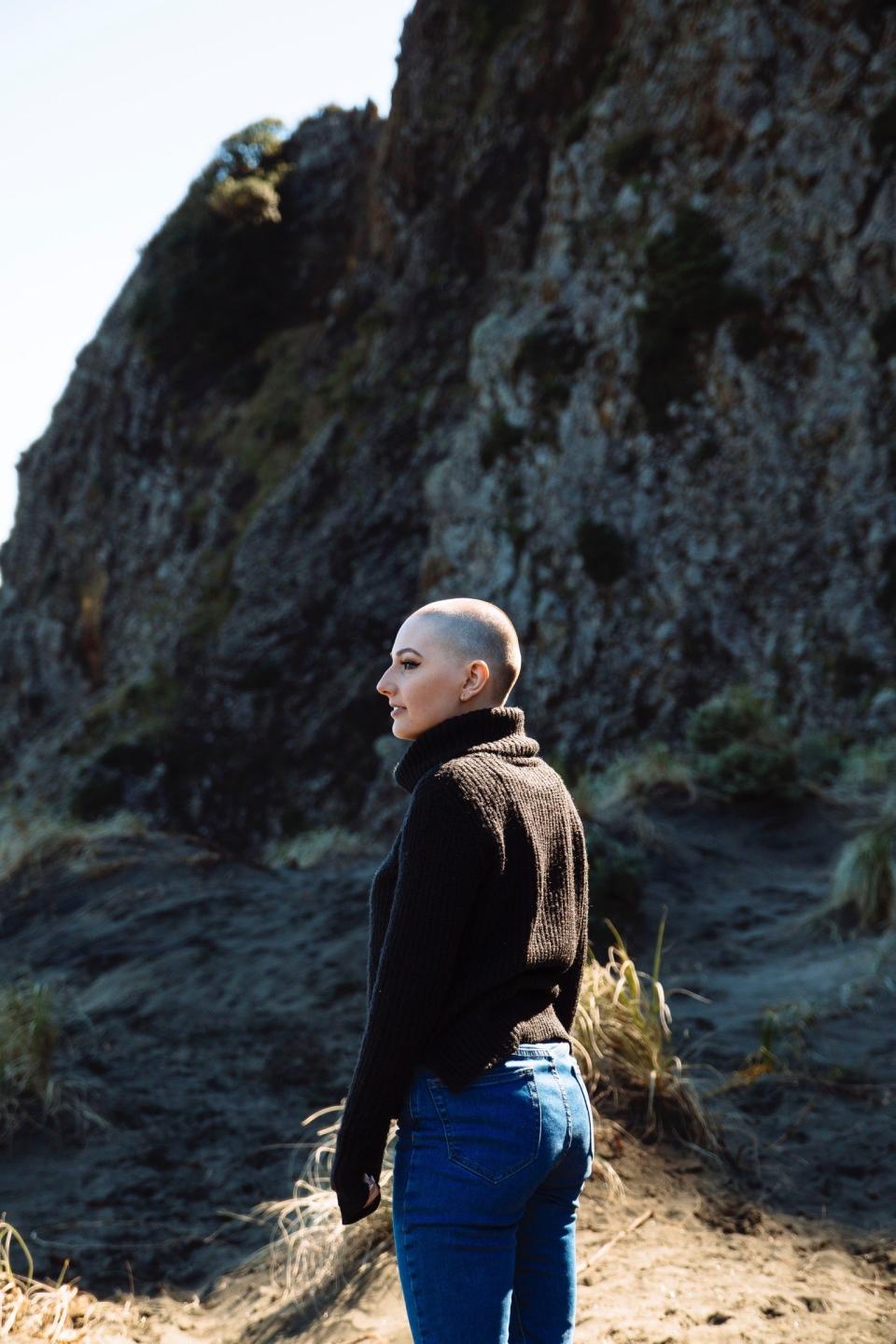 We spoke to size women about their experience with alopecia, and how their definition of beauty and self-confidence has changed.