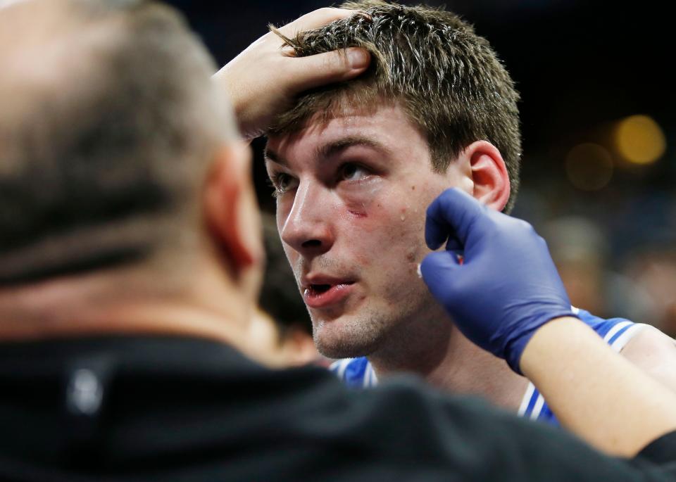 Mar 18, 2023; Orlando, FL, USA; Duke Blue Devils center Kyle Filipowski (30) gets treatment after receiving a cut under his eye against the Tennessee Volunteers during the first half in the second round of the 2023 NCAA Tournament at Legacy Arena. Mandatory Credit: Russell Lansford-USA TODAY Sports