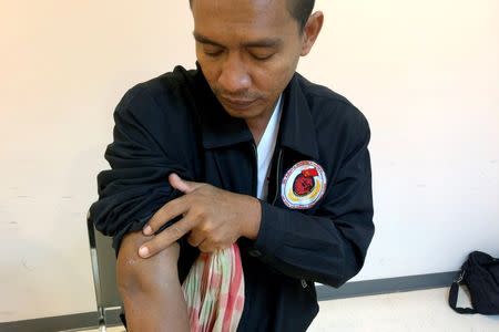 Supot Kalasong, 41, shows a scar from a gunshot wound he suffered in April during an interview with Thomson Reuters Foundation at Thailand's National Human Rights Commission office in Bangkok, Thailand May 19, 2016. REUTERS/Alisa Tang