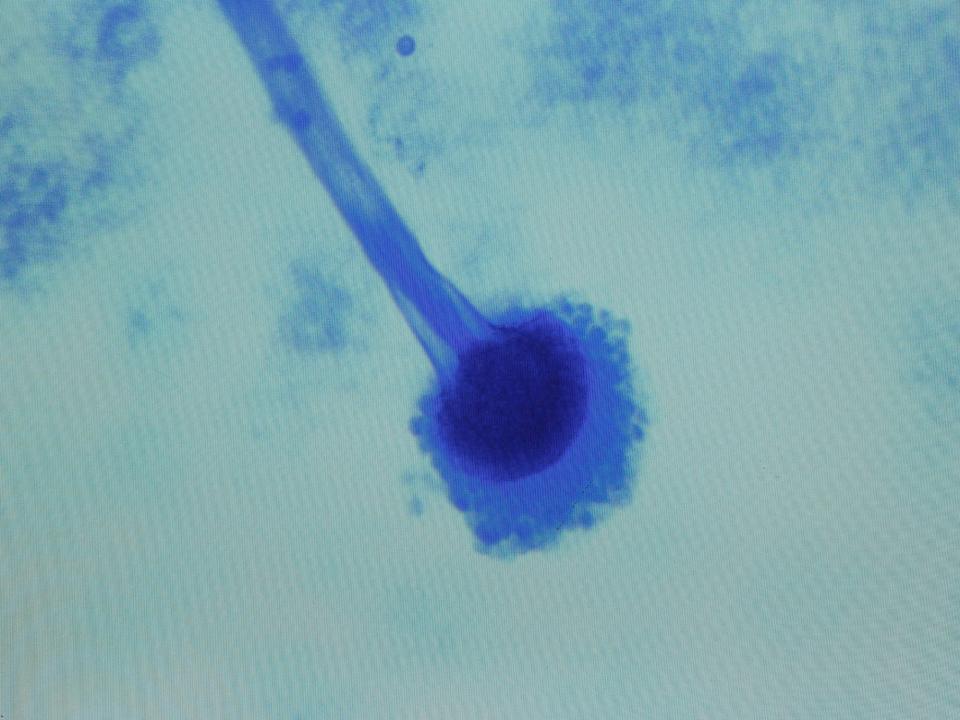 blue fungus sprout with a fuzzy head microscope image