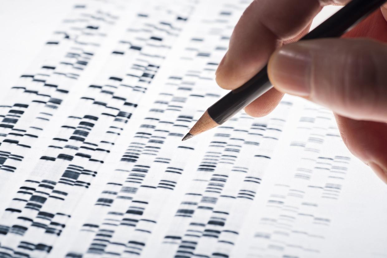 Focus on a male scientist's hand holding a pencil, inspecting a DNA gel