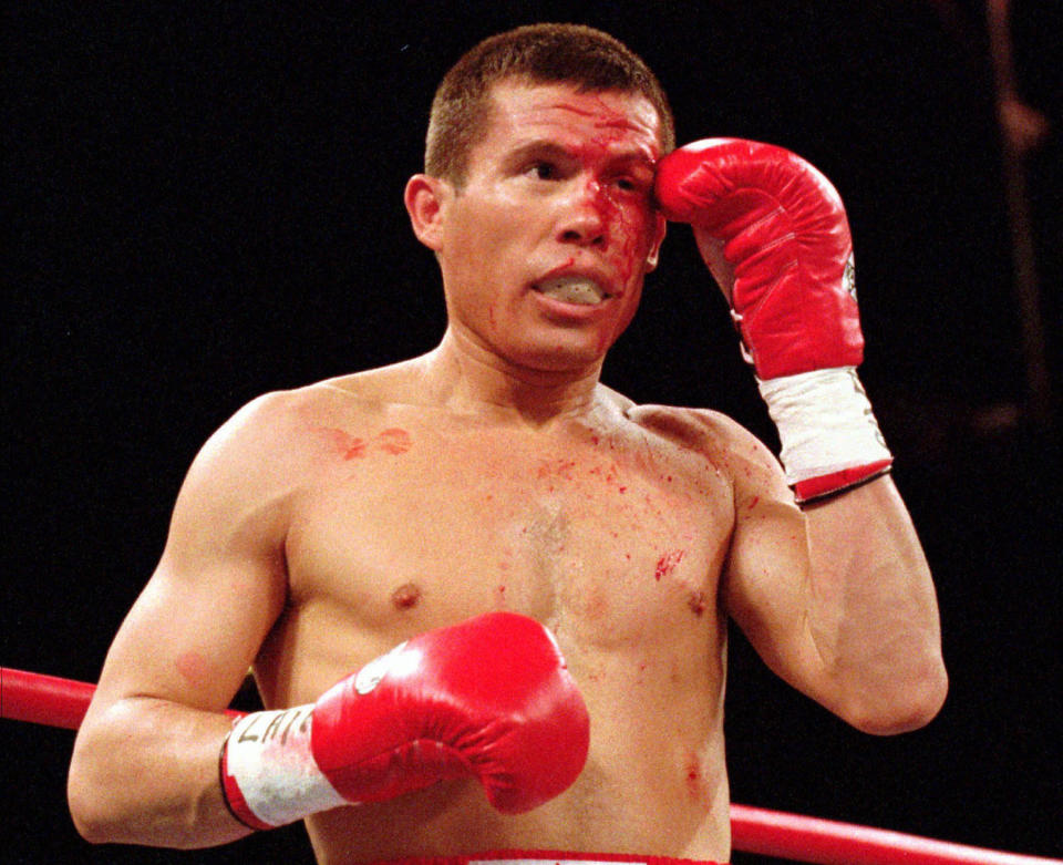 FILE - Julio César Chávez covers up his left eye during his WBC super lightweight championship against Oscar De La Hoya in Las Vegas on June 7, 1996. A new film, “La Guerra Civil,” by Eva Longoria Bastón, examines the cultural divide the fight illuminated for many Mexican-Americans. The documentary premiered Thursday night at the Sundance Film Festival. (AP Photo/Jeff Scheid, File)