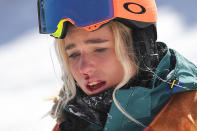 <p>L’Australienne Emily Arthur le nez en sang, après sa chute en finale du snowboard halfpipe. (Photo AFP) </p>