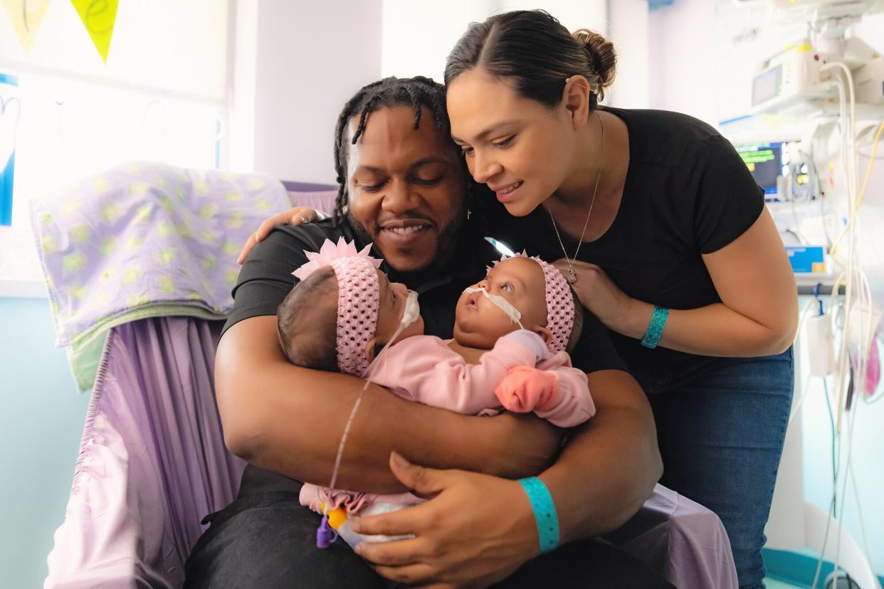 JamieLynn and AmieLynn, Conjoined Twin Girls Separated at Cook Children’s Medical Center Make History