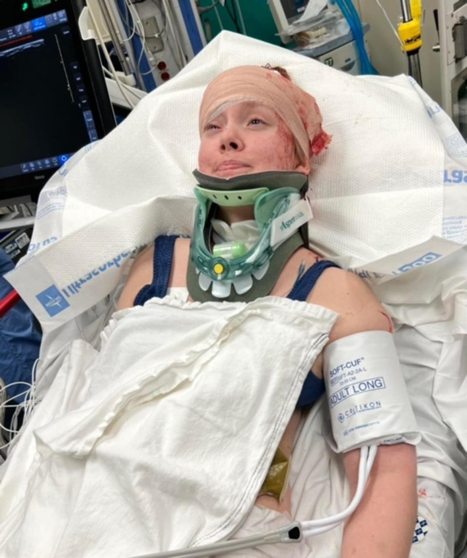 Caitlin is pictured in the hospital after suffering a fall and brain bleed in February, just days after she and her family moved into their new, specially-outfitted home (Facebook/Darlene Jensen)