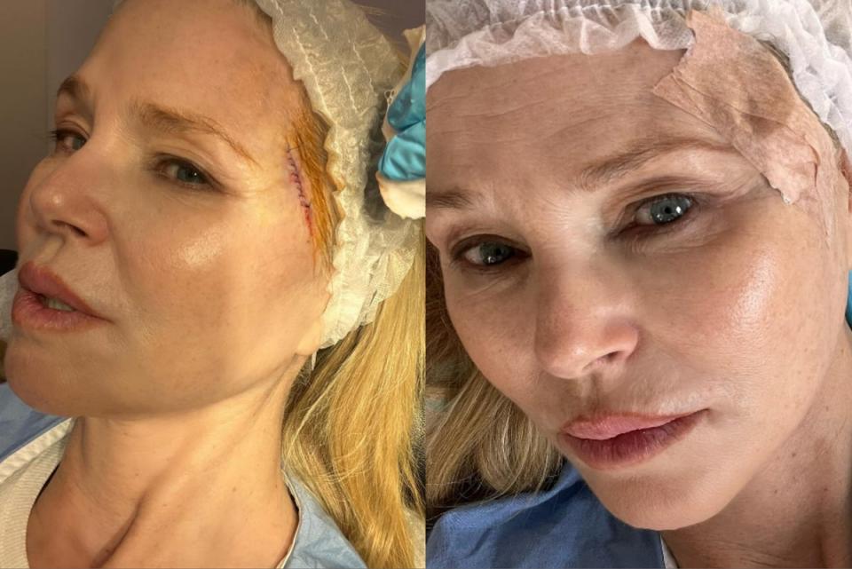 Christie Brinkley shares pictures after cancer cell operation (Instagram / Christie Brinkley)