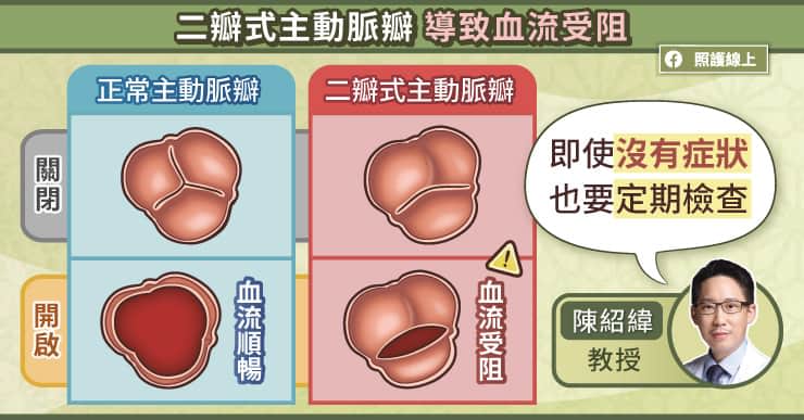 兩瓣式主動脈瓣導致血流受阻