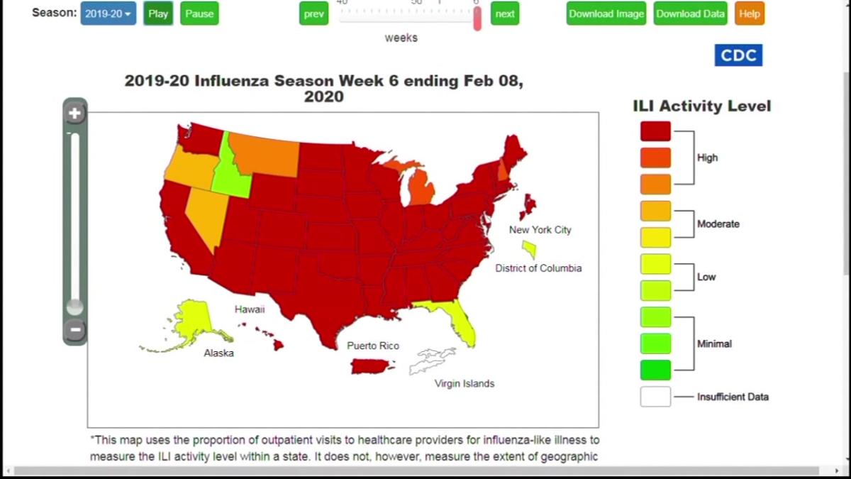 Flu activity peaking across Bay Area and US