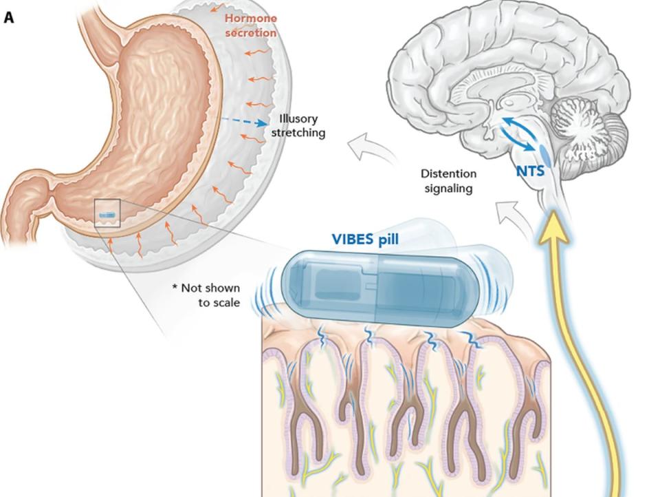 Infografía del funcionamiento de la pastilla VIBE | Srinivasan, Shriya S., et al. Science Advances (2023)