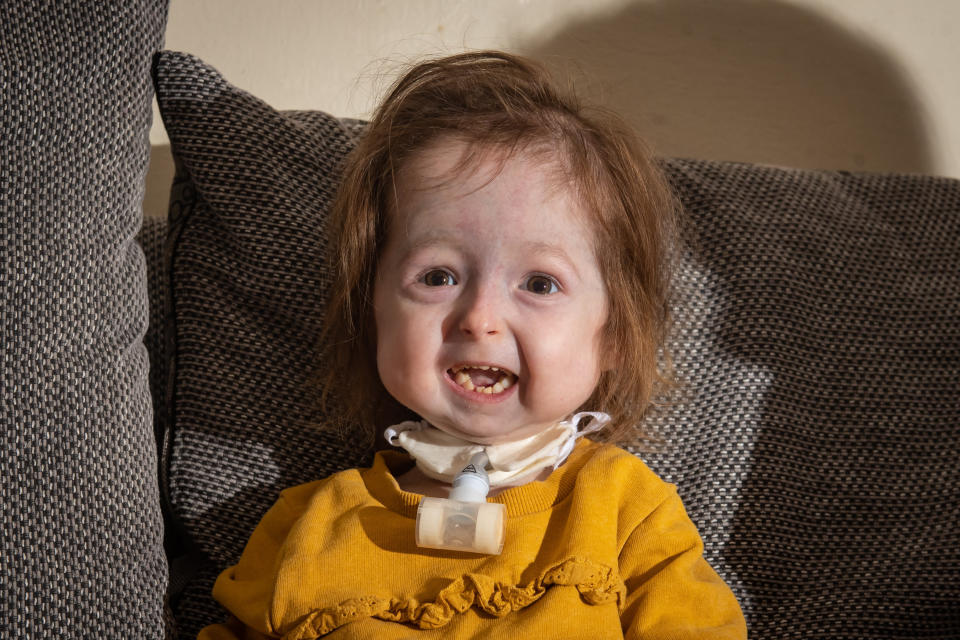 Isla Kilpatrick-Screaton is thought to be the "only person" with a specific aging mutation. (Photo: SWNS)