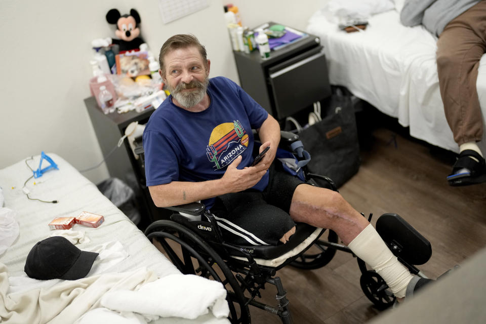 Ron Falk, 62, speaks of losing his leg, Tuesday, June 25, 2024 in Phoenix. Falk lost his right leg, had extensive skin grafting on the left one and is still recovering a year after collapsing on the searing asphalt outside a convenience store where he stopped for a cold soda during a blistering heat wave. (AP Photo/Matt York)