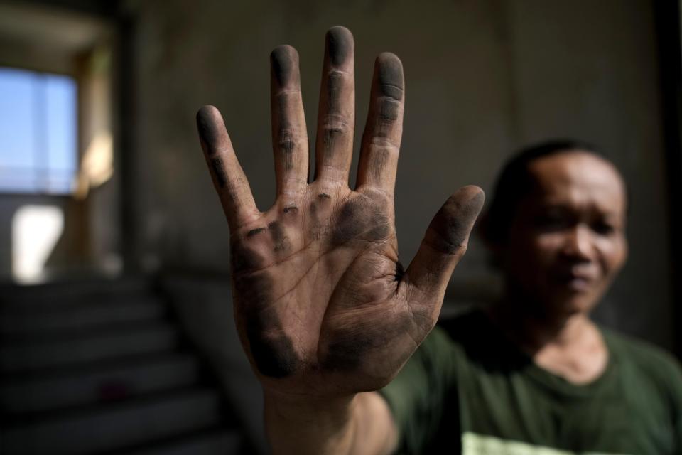 Cecep Supriyadi shows his dirty hand after touching a net installed to prevent dust particles from nearby factories and coal stockpile from entering their apartment t in Jakarta, Indonesia, Friday, June 9, 2023. Almost the entire world breathes air that exceeds the World Health Organization's air-quality limits at least occasionally. (AP Photo/Dita Alangkara)
