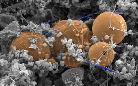 Candidatus Desulforudis audaxviator (the purplish, blue rod-shaped cells straddling orange carbon spheres) is a species of bacteria that survives on hydrogen. Scientists found it living within a fluid and gas-filled fracture 2.8 km beneath Earth's surface at a mine near Johannesburg, South Africa - Credit: Greg Wanger, California Institute of Technology, USA, and Gordon Southam University of Queensland, Australia