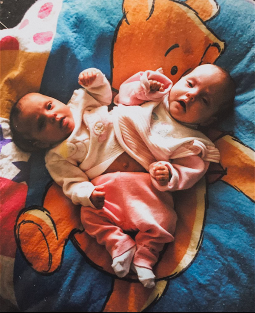 Gabby and Michaela Garcia, pictured before the surgery to separate them; ‘everyone’ urged mother Karen to abort them, Ms Garcia says (Gabby Garcia)