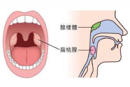 別輕忽孩子打呼！身體長期慢性發炎問題多