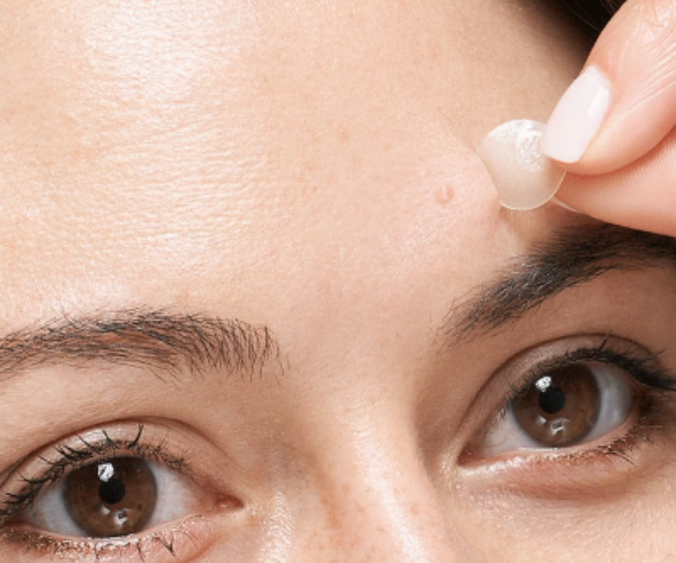 A close up of a brown eyed woman's forehead as she peels a transluscent pimple patch off a small pimple.