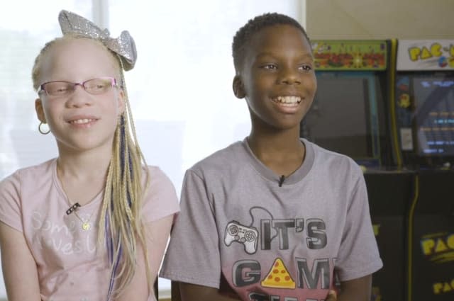 The nine-year-old twins born different