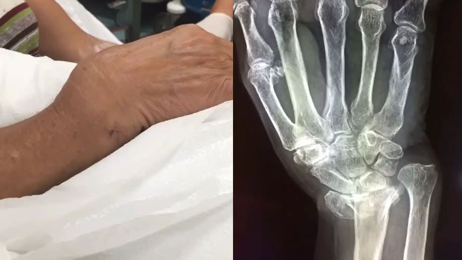 A grandmother broke her wrist after falling from a hoverboard in Hawai'i. Photo: Instagram