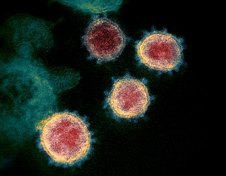 Electron micrograph of SARS-CoV-2 virus particles with visible spike proteins.