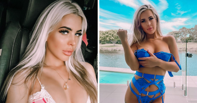 Glamour model's 36E fake boobs MELTED when she spilt boiling hot