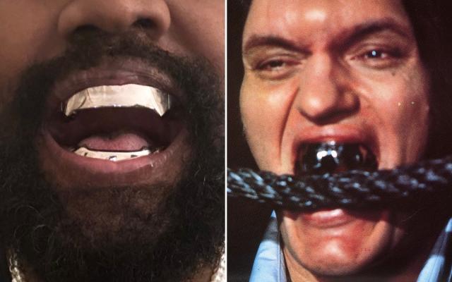 Kanye West can no longer chew food as £667,000 titanium teeth