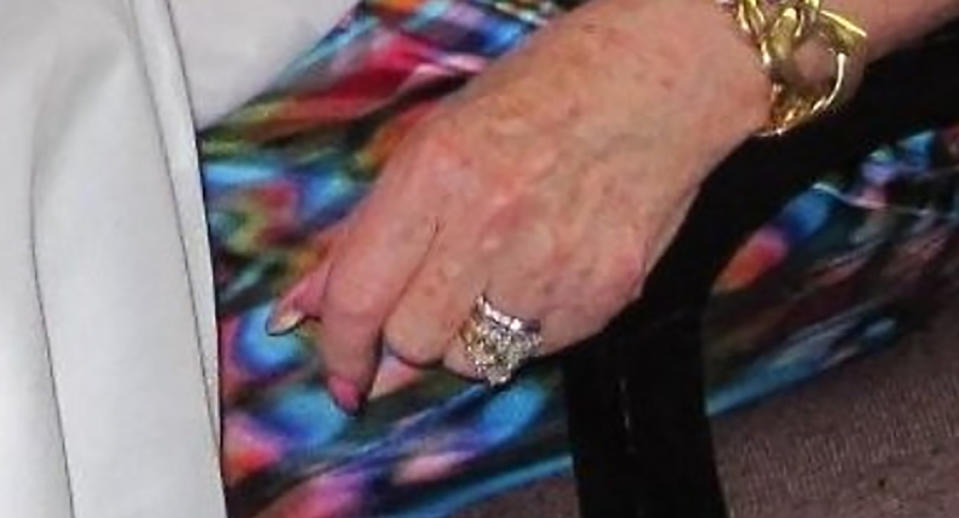 Engagement and wedding rings are pictured on an elderly woman's hand.