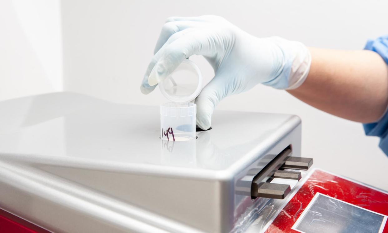 <span>Slides being prepared as part of a smear test. The UK death rate among women from cervical cancer fell by 54.3%, the study found.</span><span>Photograph: Anamaria Mejia/Shutterstock</span>
