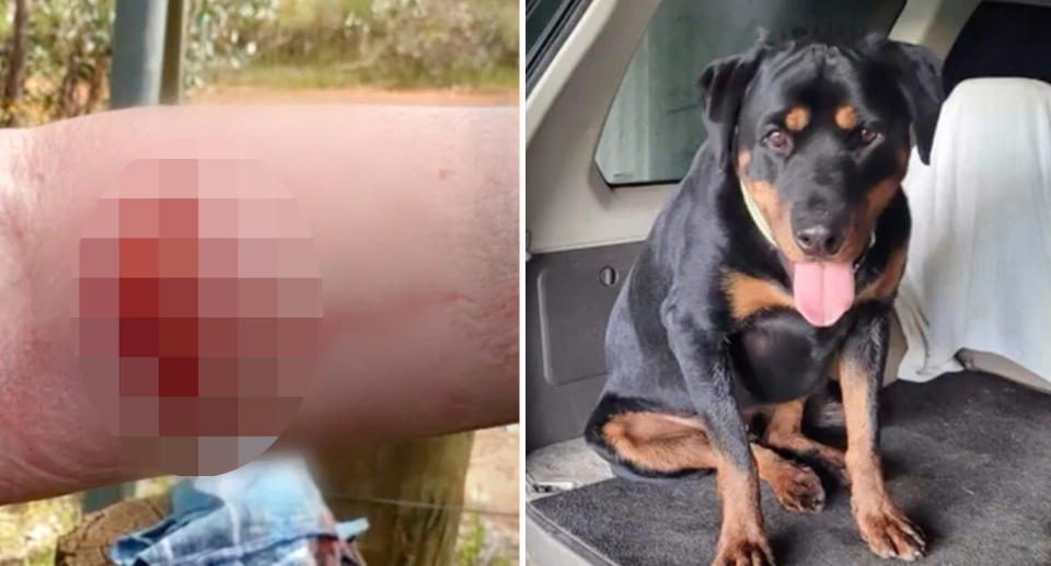 A photo of a woman's arm which was injured by a kangaroo, and another photo of her dog Bundy who chased the kangaroo away.