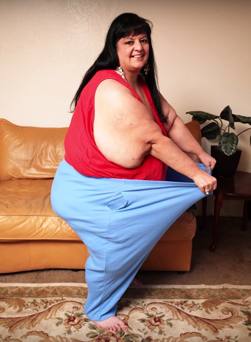 Con el apoyo de los especialistas, su familia y su novio, Patty ha sido capaz de perder 120 kilos (264 libras). “Antes, estaba demasiado obesa para hacer cualquier cosa, pero ahora siento entusiasmo por la vida de nuevo”, aseguró Betty.